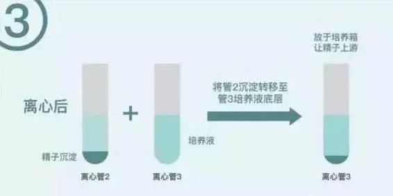 泰国试管婴儿手术医院