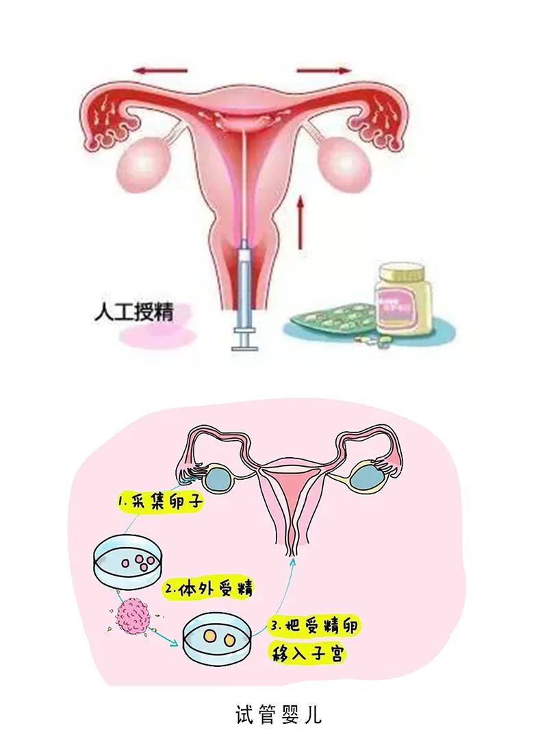 泰国试管婴儿
